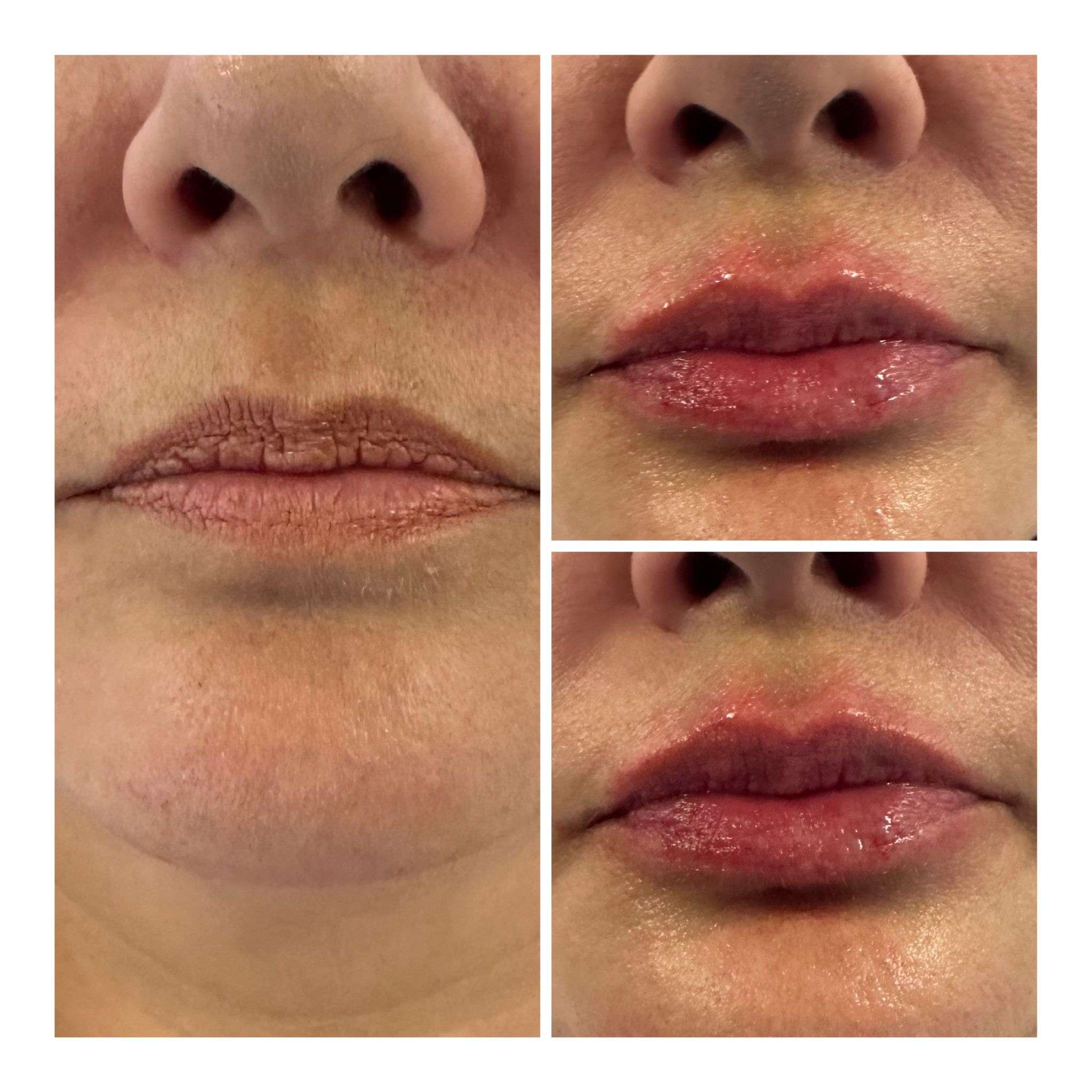 Anti-Aging Treatment